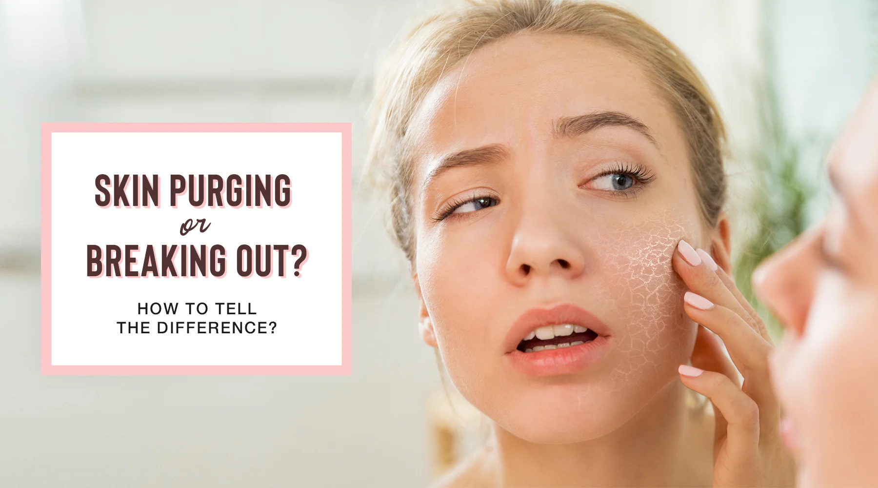 Skin Purging: What You Need to Know